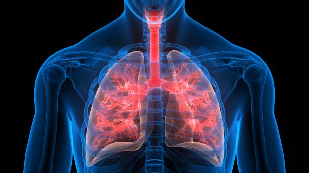 Tuberculosis is basically an infection caused by bacteria, its prime target is lungs.