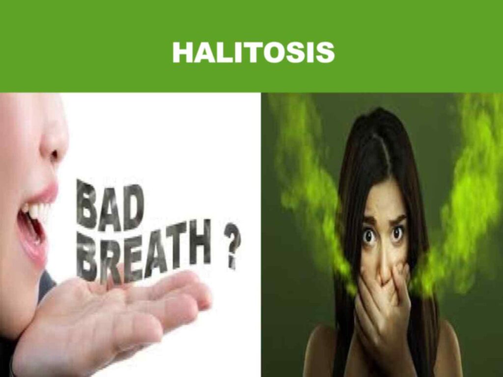 Halitosis is a term used for bad breath. 
