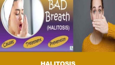 Halitosis is a term used for bad breath or oral malodor.