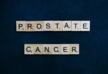 Prostate cancer is considered a common type of cancer which is prevalent among males.