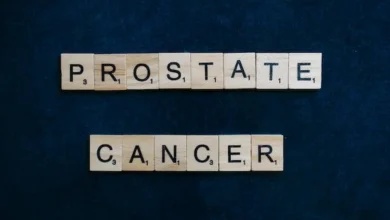 Prostate cancer is considered a common type of cancer which is prevalent among males.