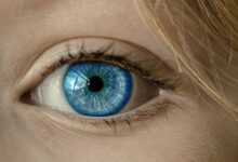 Bitot spots are small, foamy, or bubbly white patches that appear on the white part of the eye (the conjunctiva).
